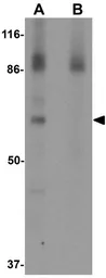 Anti-ESRP1 antibody used in Western Blot (WB). GTX31825