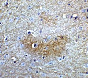 Anti-GLS2 antibody used in IHC (Paraffin sections) (IHC-P). GTX31828