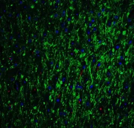 Anti-GLS2 antibody used in IHC (Paraffin sections) (IHC-P). GTX31828