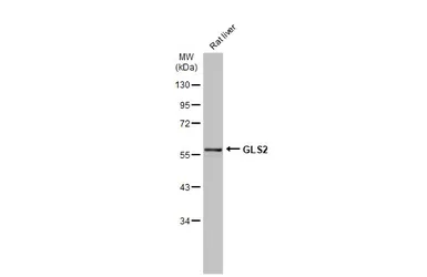 Anti-GLS2 antibody used in Western Blot (WB). GTX31828