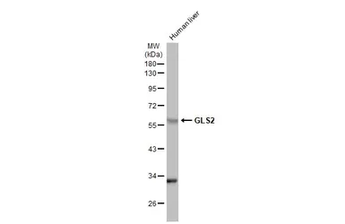 Anti-GLS2 antibody used in Western Blot (WB). GTX31828
