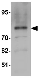 Anti-ZFP219 antibody used in Western Blot (WB). GTX31829
