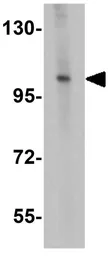 Anti-ZNF281 antibody used in Western Blot (WB). GTX31830