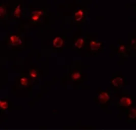 Anti-ZNF281 antibody used in Immunocytochemistry/ Immunofluorescence (ICC/IF). GTX31830