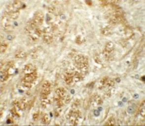 Anti-ATP2C1 antibody used in IHC (Paraffin sections) (IHC-P). GTX31834