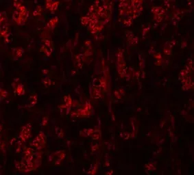 Anti-ATP2C1 antibody used in IHC (Paraffin sections) (IHC-P). GTX31834