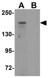 Anti-ATP2C1 antibody used in Western Blot (WB). GTX31834