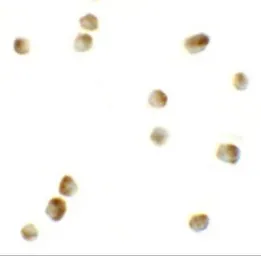 Anti-ROCK1 antibody used in Immunocytochemistry/ Immunofluorescence (ICC/IF). GTX31836