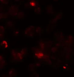 Anti-ROCK1 antibody used in Immunocytochemistry/ Immunofluorescence (ICC/IF). GTX31836