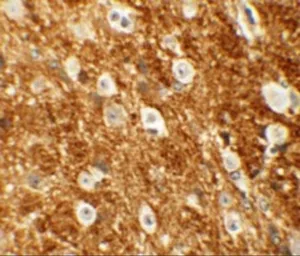Anti-ROCK2 antibody used in IHC (Paraffin sections) (IHC-P). GTX31837