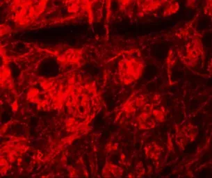 Anti-ROCK2 antibody used in IHC (Paraffin sections) (IHC-P). GTX31837