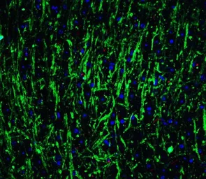 Anti-Musashi 2 antibody used in IHC (Paraffin sections) (IHC-P). GTX31838