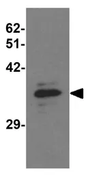Anti-Musashi 2 antibody used in Western Blot (WB). GTX31838