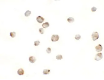 Anti-Musashi 2 antibody used in Immunocytochemistry/ Immunofluorescence (ICC/IF). GTX31838