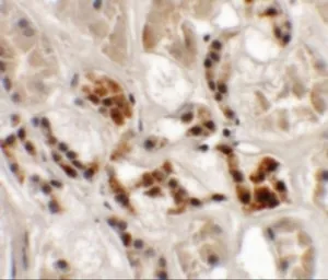 Anti-AP3S1 antibody used in IHC (Paraffin sections) (IHC-P). GTX31839