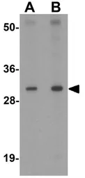 Anti-AP3S1 antibody used in Western Blot (WB). GTX31839