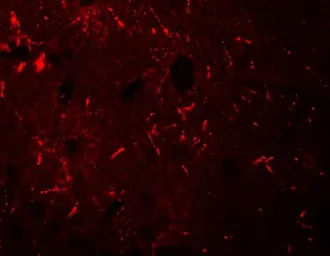Anti-KCNK12 antibody used in IHC (Paraffin sections) (IHC-P). GTX31840
