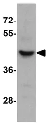 Anti-SLC35D3 antibody used in Western Blot (WB). GTX31842