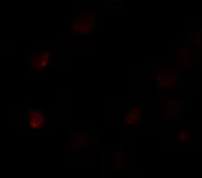 Anti-SLC35D3 antibody used in Immunocytochemistry/ Immunofluorescence (ICC/IF). GTX31842
