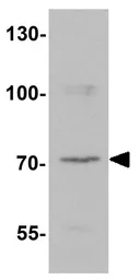 Anti-LZTS2 antibody used in Western Blot (WB). GTX31845