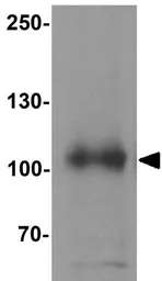 Anti-SIPA1 antibody used in Western Blot (WB). GTX31846