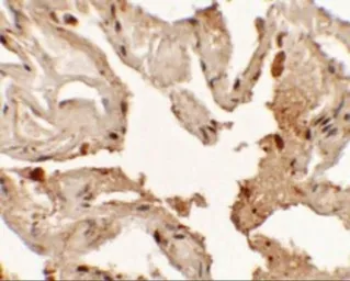 Anti-NKX2.1 antibody used in IHC (Paraffin sections) (IHC-P). GTX31847