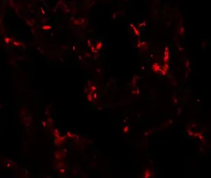 Anti-NKX2.1 antibody used in IHC (Paraffin sections) (IHC-P). GTX31847