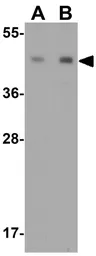 Anti-NKX2.1 antibody used in Western Blot (WB). GTX31847