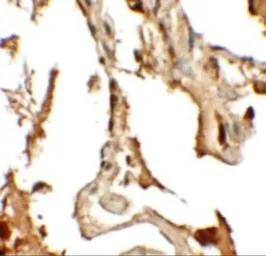 Anti-RILPL2 antibody used in IHC (Paraffin sections) (IHC-P). GTX31848