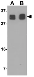 Anti-RILPL2 antibody used in Western Blot (WB). GTX31848