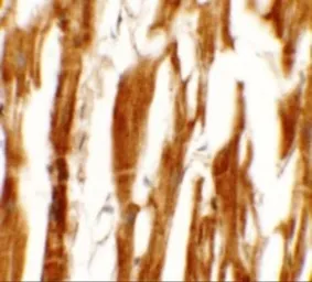 Anti-ERR beta antibody used in IHC (Paraffin sections) (IHC-P). GTX31852