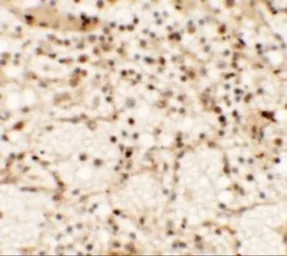 Anti-Dectin-1 antibody used in IHC (Paraffin sections) (IHC-P). GTX31853