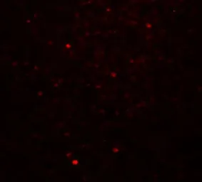 Anti-Dectin-1 antibody used in IHC (Paraffin sections) (IHC-P). GTX31853