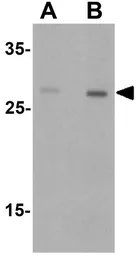 Anti-Dectin-1 antibody used in Western Blot (WB). GTX31853