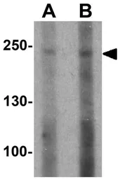 Anti-ABCA7 antibody used in Western Blot (WB). GTX31856