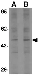 Anti-LEMD2 antibody used in Western Blot (WB). GTX31857