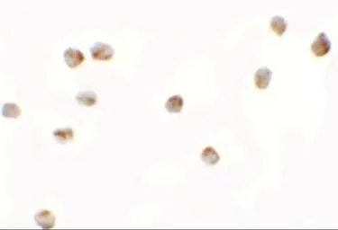 Anti-LEMD2 antibody used in Immunocytochemistry/ Immunofluorescence (ICC/IF). GTX31857