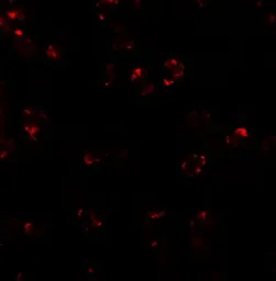 Anti-LEMD2 antibody used in Immunocytochemistry/ Immunofluorescence (ICC/IF). GTX31857