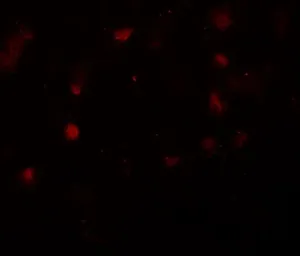 Anti-CASK antibody used in IHC (Paraffin sections) (IHC-P). GTX31858