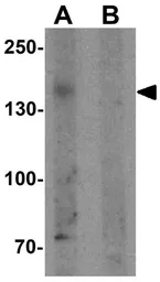 Anti-PHLPP2 antibody used in Western Blot (WB). GTX31862