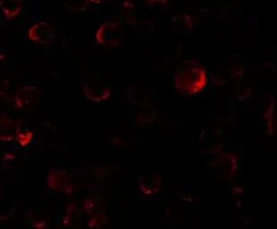 Anti-PHLPP2 antibody used in Immunocytochemistry/ Immunofluorescence (ICC/IF). GTX31862