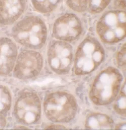 Anti-STAT3 antibody used in IHC (Paraffin sections) (IHC-P). GTX31870