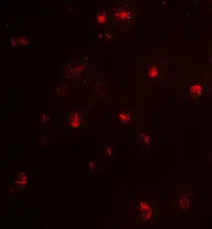 Anti-CARM1 antibody used in Immunocytochemistry/ Immunofluorescence (ICC/IF). GTX31871