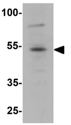 Anti-FOXA1 antibody used in Western Blot (WB). GTX31874