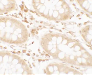 Anti-TORC2 antibody used in IHC (Paraffin sections) (IHC-P). GTX31879