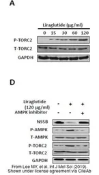 Anti-TORC2 antibody used in Western Blot (WB). GTX31879