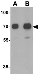 Anti-TORC2 antibody used in Western Blot (WB). GTX31879