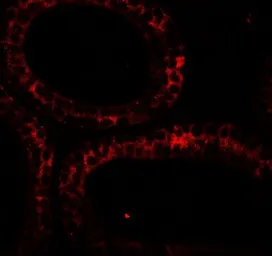 Anti-DIS3 antibody used in IHC (Paraffin sections) (IHC-P). GTX31880