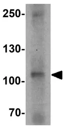 Anti-DIS3 antibody used in Western Blot (WB). GTX31880