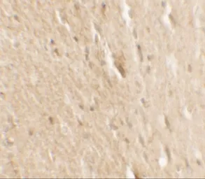 Anti-B-Raf antibody used in IHC (Paraffin sections) (IHC-P). GTX31881